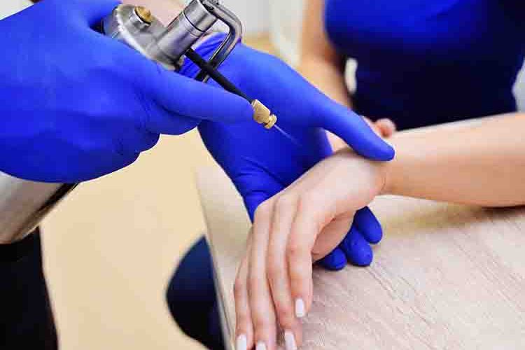 em primeiro plano, mão com uma luva azul segurando um recipiente com nitrogênio líquido, em segundo plano, uma paciente mulher de pele clara realizando o procedimento na mão.
